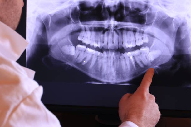 Best Walk-In Emergency Dental Services in Wallace, NC