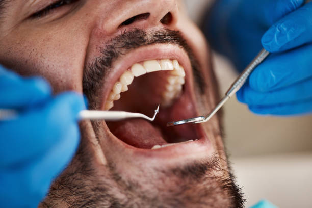 Best Emergency Root Canal Therapy in Wallace, NC