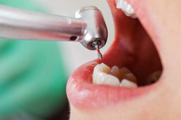Best Emergency Treatment for Oral Infections in Wallace, NC